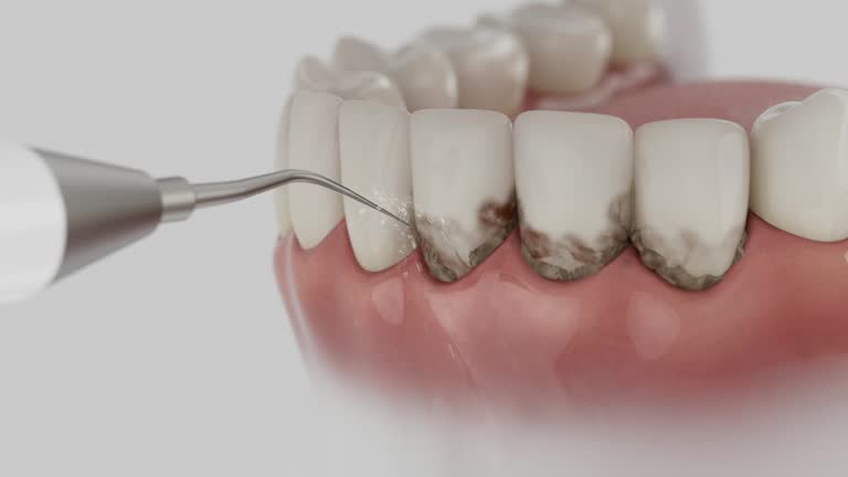 Reliable Dental Implants contractor in Wyandotte County County, KS by Dentist Open Now